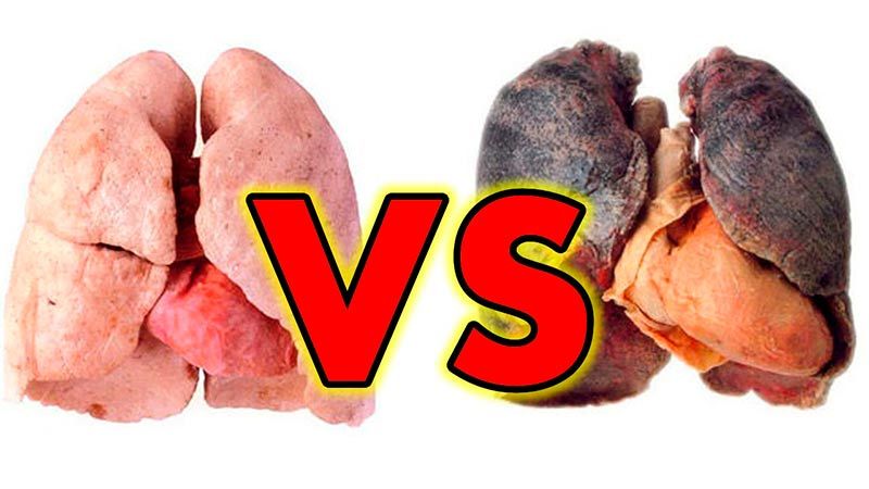 Pulmones sanos y pulmones de fumador