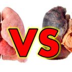 Pulmones sanos y pulmones de fumador