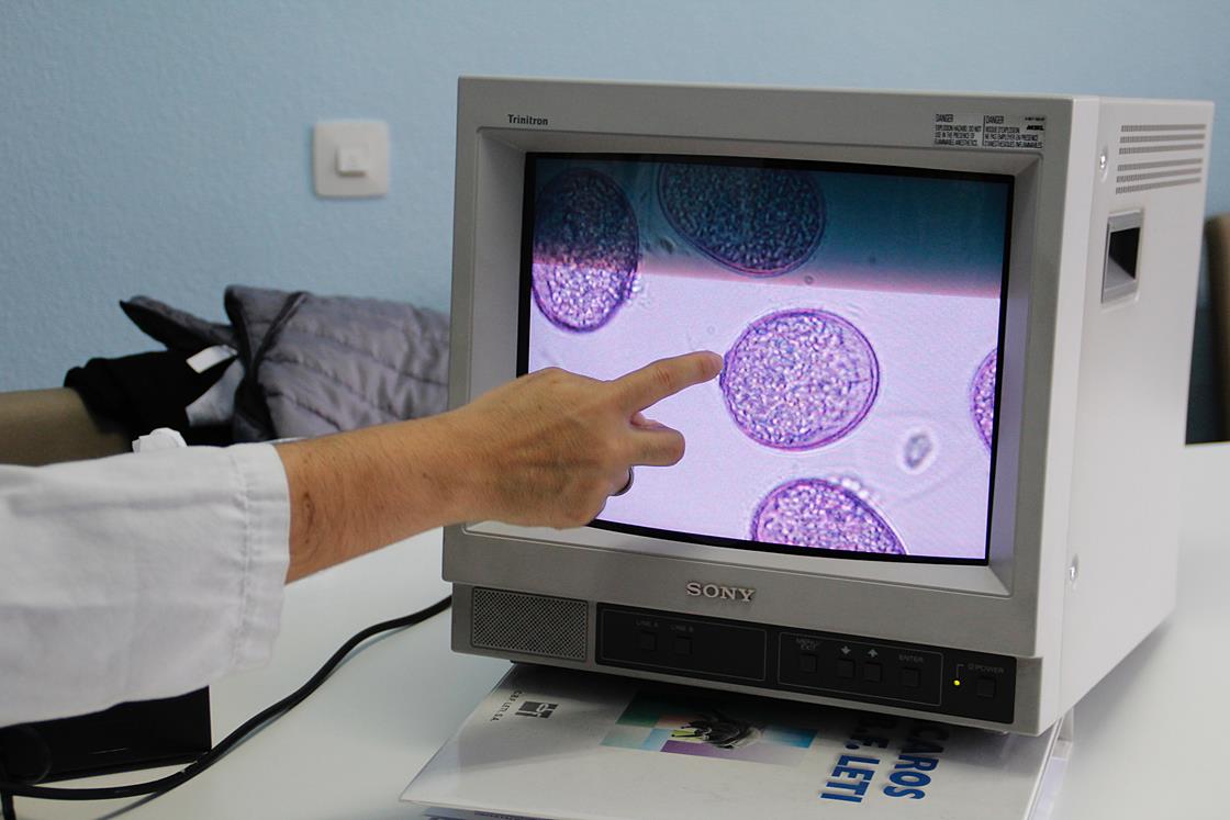 Lo que se puede ver del polen a través del microscopio.