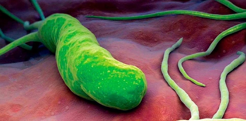 Helicobacter pylori (Lts Salud)