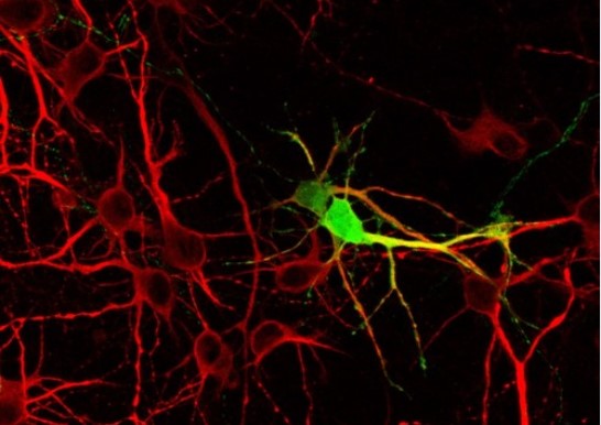 neuronas en cultivo dicyt
