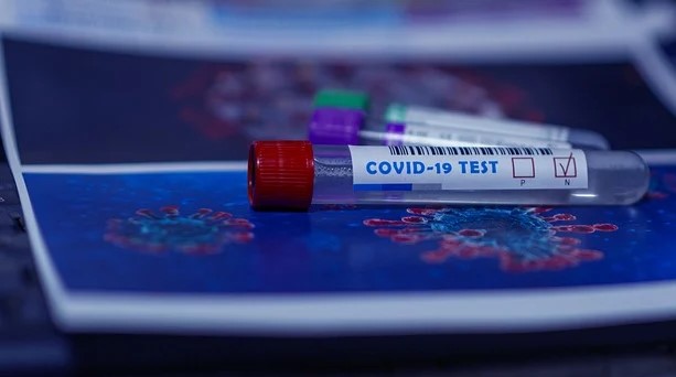 test coronavirus