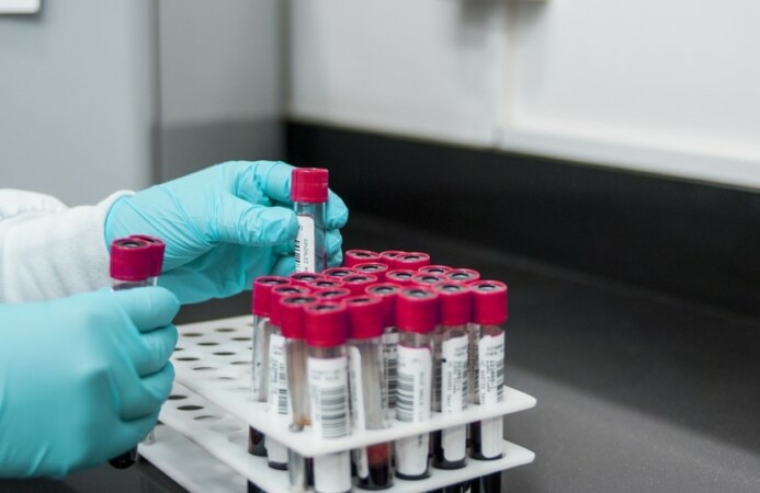 laboratorio sangres leucemia analisis investigacion pixabay