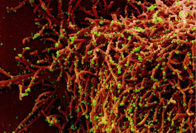 micrografia electronica coloreada de rojo infectada con coronavirus coloreado verde NIAID