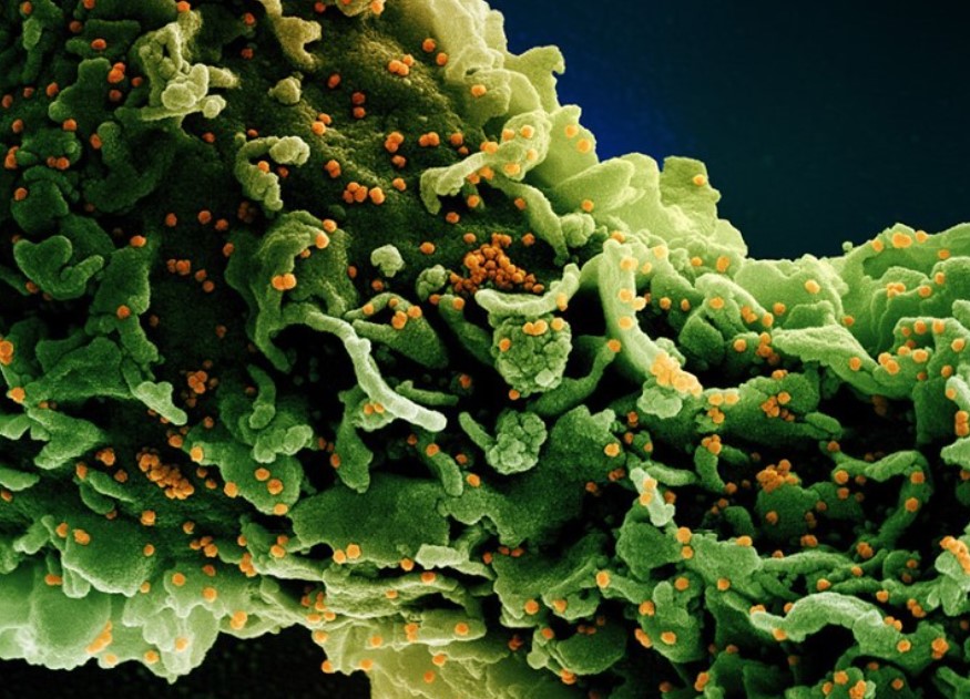 micrografia celula coloreada verde infectada con coronavirus coloreado naranja NIAID