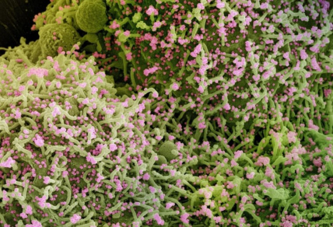 micrografia electronica celula coloreada verde con cornavirus coloreado rosa NIAID